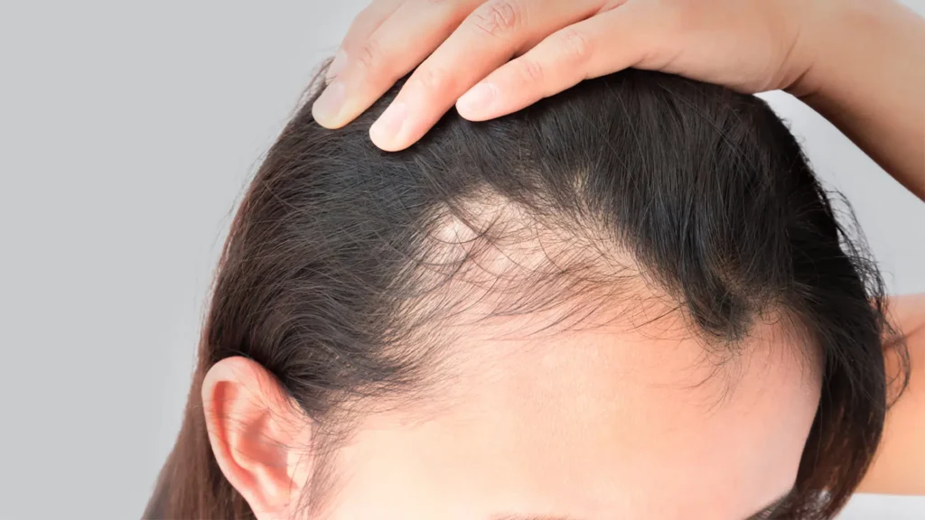 Haarpigmentierung bei Frauen – natürliche optische Verdichtung für ein harmonisches Ergebnis