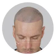 Haarpigmentierung Rating Optic Hair