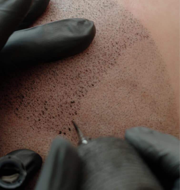 Dank Haarpigmentierung wieder dichtes Haar – natürlich wirkende optische Verdichtung