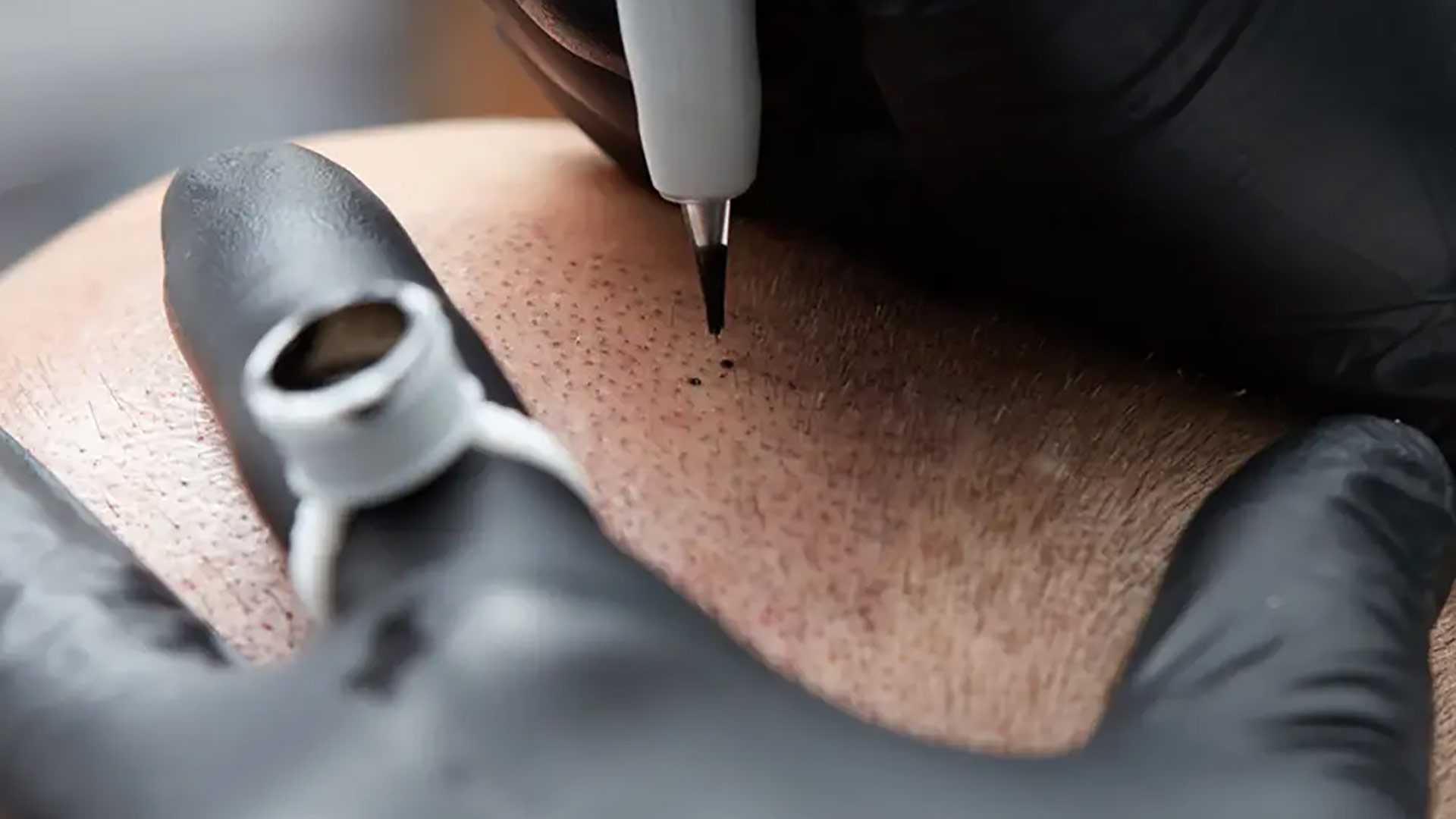 Haarpigmentierung Patient – zufriedener Patient nach professioneller Kopfhautpigmentierung mit natürlichem Look