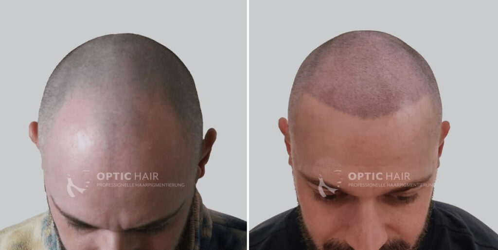 Haarpigmentierung mit dichtem Ergebnis – gleichmäßige Pigmentierung für einen vollen Look