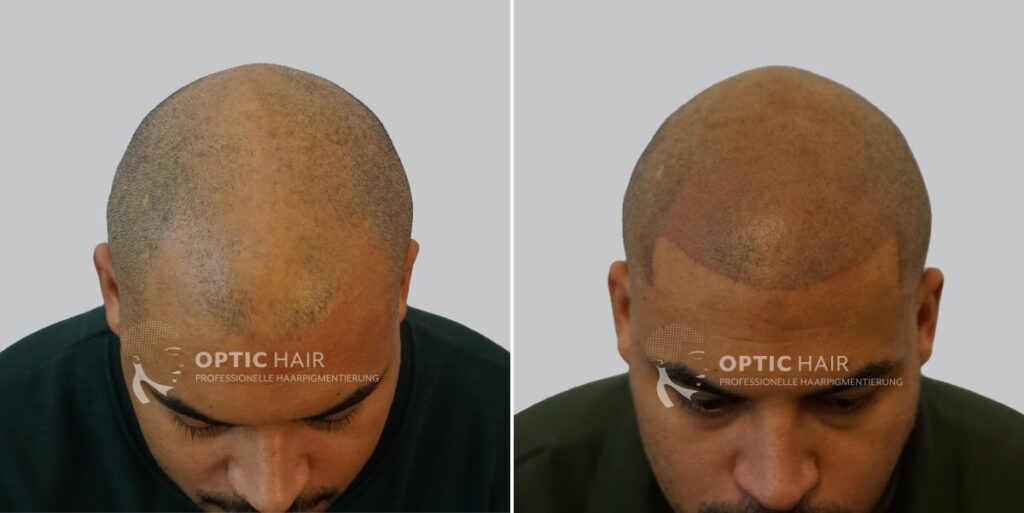 Haarpigmentierung mit dichtem Ergebnis – gleichmäßige Verdichtung mit natürlicher Wirkung
