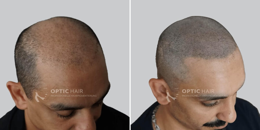 Haarpigmentierung mit natürlichem Ergebnis – gleichmäßige Pigmentierung für einen authentischen Look