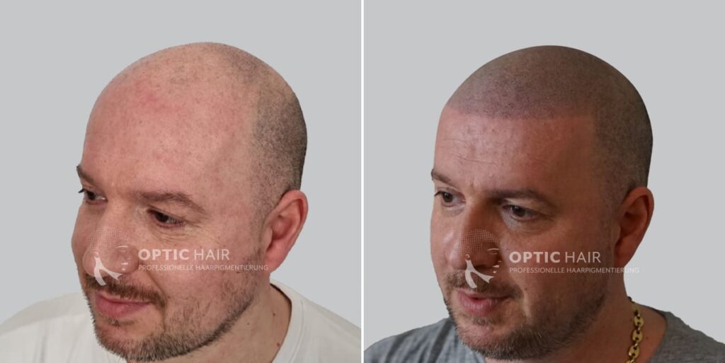 Haarpigmentierung vorher nachher – sichtbarer Unterschied mit natürlichem Ergebnis