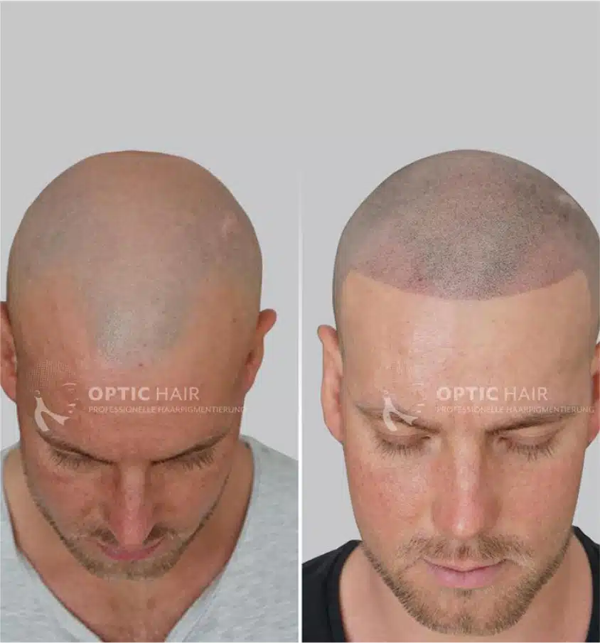 Haarpigmentierung vorher nachher – perfektes Ergebnis mit natürlicher Wirkung