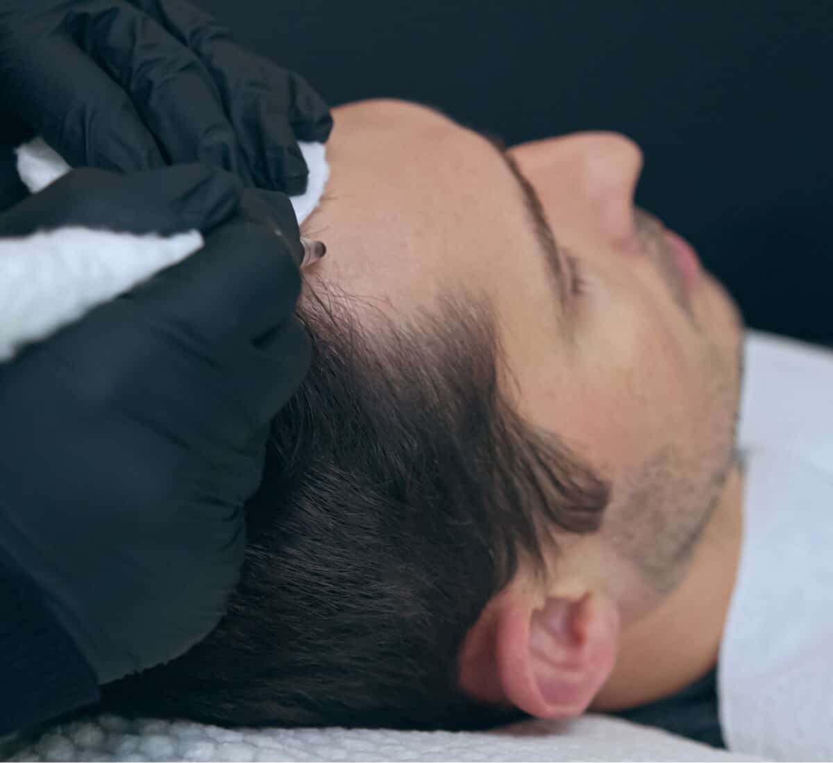 Kostenlose Haaranalyse – individuelle Einschätzung und Beratung zur Haarpigmentierung