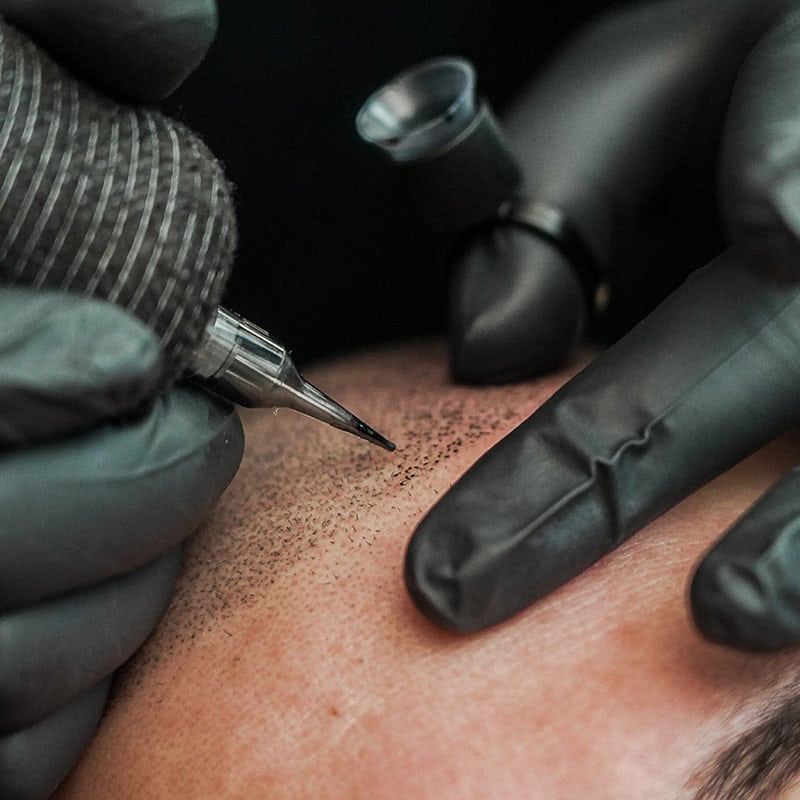 Vorbereitung für die Haarpigmentierung – professionelle Planung und Reinigung der Kopfhaut vor der Behandlung