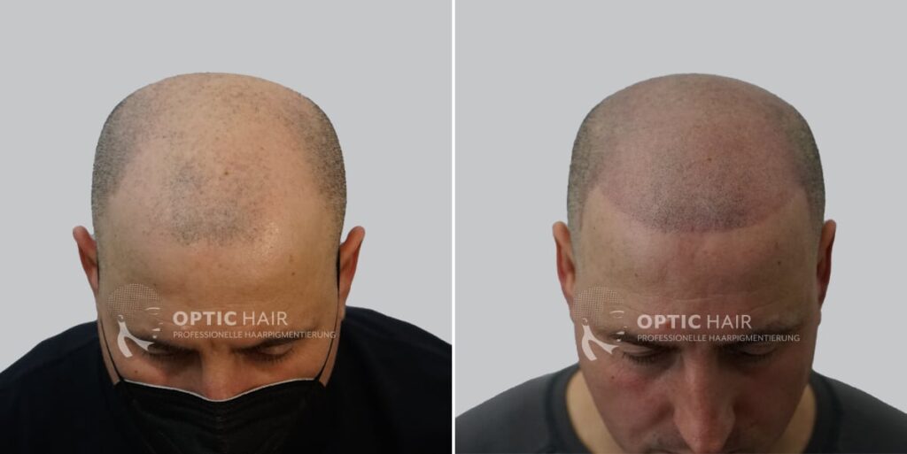 Haarpigmentierung mit dichtem Ergebnis – gleichmäßige Pigmentierung für einen vollen Look