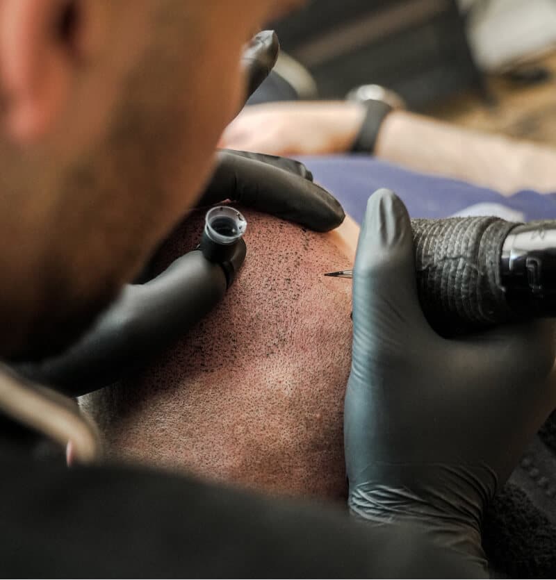 Vorher-Nachher-Ergebnis als wichtiges Qualitätskriterium – sichtbarer Erfolg einer professionellen Haarpigmentierung